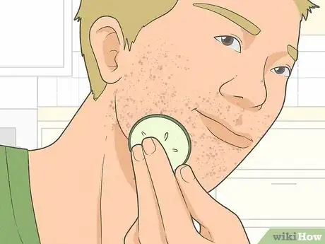 Imagen titulada Get Rid of Razor Burn Fast Step 7