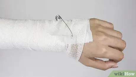 Imagen titulada Strap an Elbow Step 10