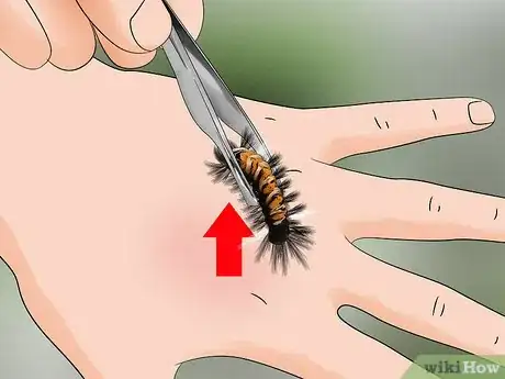 Imagen titulada Treat a Caterpillar Sting Step 1