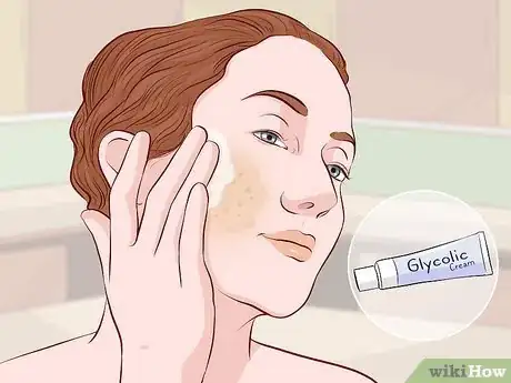 Imagen titulada Get Rid of Brown Spots Using Home Remedies Step 1