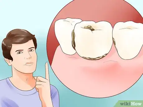 Imagen titulada Determine if You Need Braces Step 2