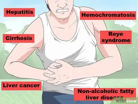 Imagen titulada Stop Liver Pain Step 13