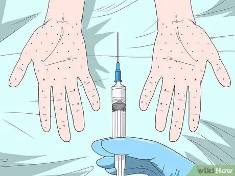 Imagen titulada Stop Shaking Hands Step 10