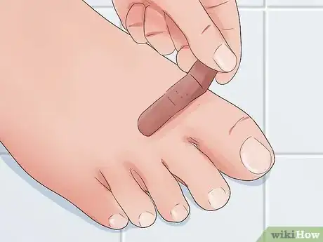 Imagen titulada Check a Wound for Infection Step 7