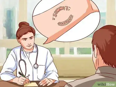 Imagen titulada Treat a Human Bite Step 8