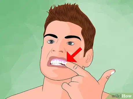Imagen titulada Ease Wisdom Tooth Pain Step 1