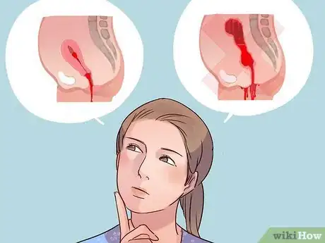 Imagen titulada Know if It's Postpartum Bleeding or a Period Step 5