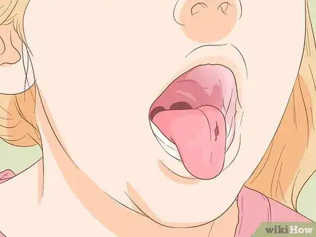 Imagen titulada Stop Tongue Bleeding Step 4