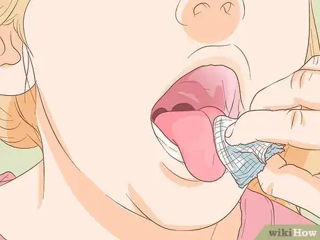 Imagen titulada Stop Tongue Bleeding Step 5