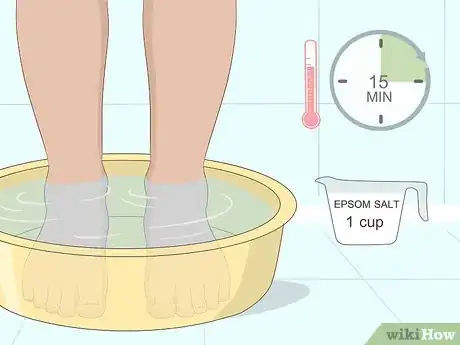 Imagen titulada Relieve Ingrown Toe Nail Pain Step 14