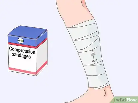 Imagen titulada Get Rid of Bruises Step 3