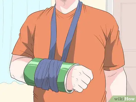 Imagen titulada Make a Sling for Your Arm Step 10