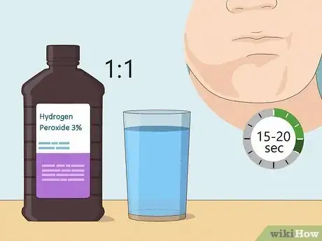Imagen titulada Heal a Bitten Tongue Step 10