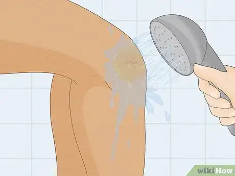 Imagen titulada Remove Iodine Stains from Skin Step 4