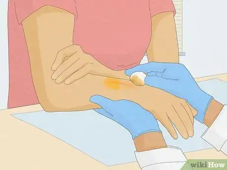 Imagen titulada Remove Iodine Stains from Skin Step 7