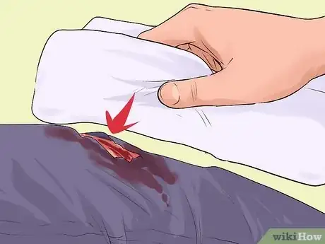 Imagen titulada Treat Severe Bleeding During First Aid Step 10