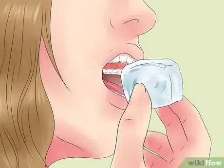 Imagen titulada Alleviate Orthodontic Brace Pain Step 2
