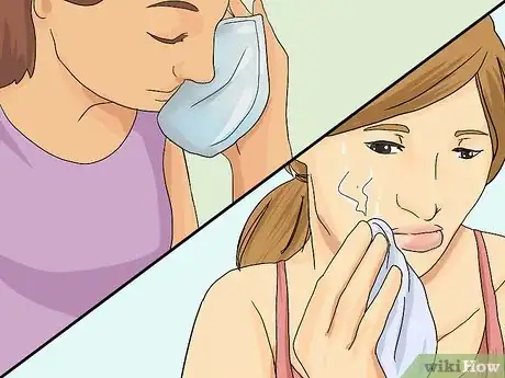 Imagen titulada Heal a Swollen Lip Step 15