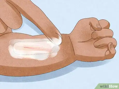 Imagen titulada Remove a Bandage from a Baby Step 8