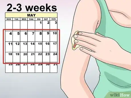 Imagen titulada Remove Keloid Scars at Home Step 15