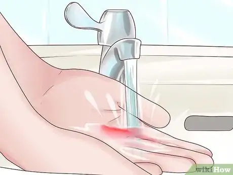 Imagen titulada Quickly Treat a Cut or Bleeding Scrape Step 1