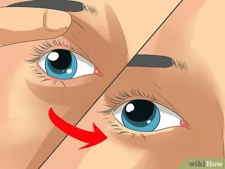 Imagen titulada Use Contact Lenses Step 17