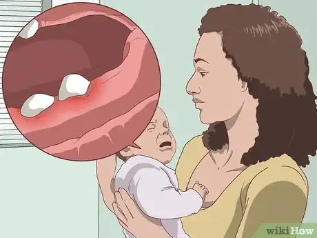 Imagen titulada Relieve Gum Pain Step 3