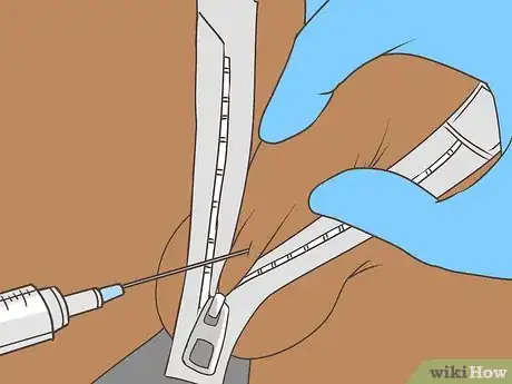 Imagen titulada Free a Penis from a Stuck Zipper Step 11