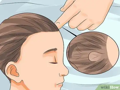 Imagen titulada Spot Meningitis in Babies Step 2