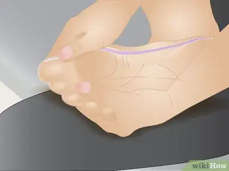 Imagen titulada Relieve Back Pain Through Reflexology Step 1