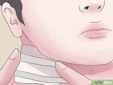 Imagen titulada Treat an Infected Sebaceous Cyst Step 13