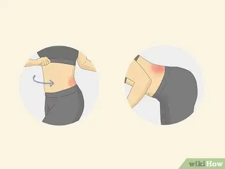 Imagen titulada Tell if Back Pain Is Due to a Muscle or Disc Step 2