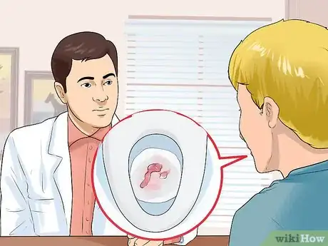 Imagen titulada Stop Hemorrhoids from Itching Step 11