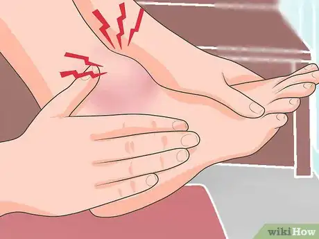 Imagen titulada Tell if a Fall Broke Bones Without an X Ray Step 5