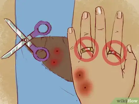 Imagen titulada Treat a Snake Bite Step 5