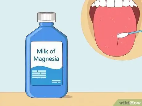 Imagen titulada Heal a Bitten Tongue Step 17