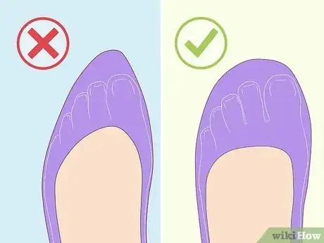 Imagen titulada Remove Spider Veins Step 4