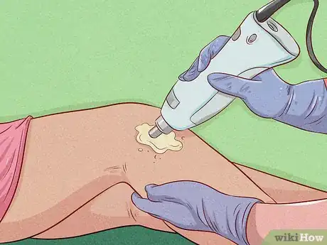 Imagen titulada Get Rid of Unwanted Hair Step 17