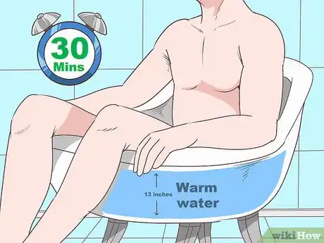 Imagen titulada Know if You Have Epididymitis Step 20