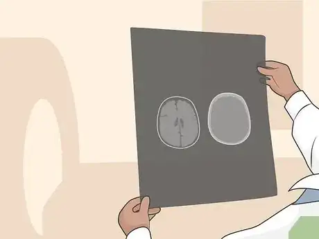 Imagen titulada Get a Brain Scan Step 4