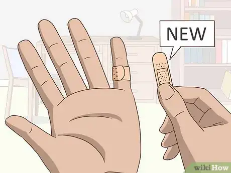 Imagen titulada Treat a Blistering Burn on Your Finger Step 11