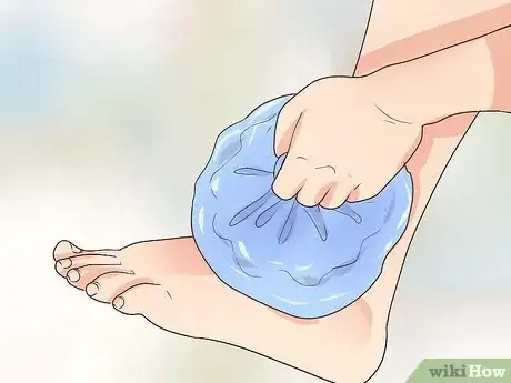 Imagen titulada Provide First Aid for a Broken Bone Step 6