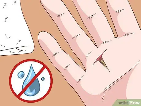 Imagen titulada Remove a Deep Splinter Step 11