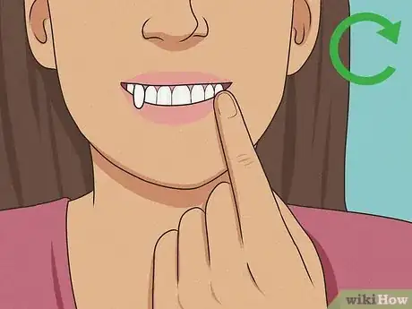 Imagen titulada Make Quick Vampire Fangs Step 9.jpeg