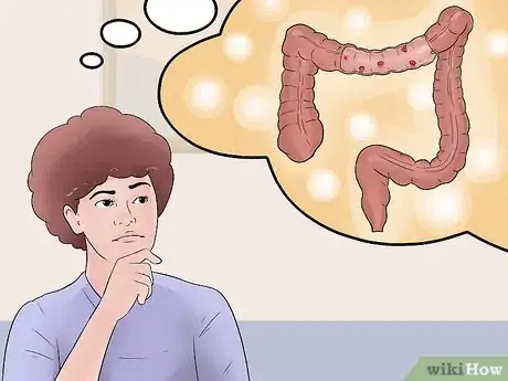 Imagen titulada Distinguish Ulcerative Colitis from Similar Conditions Step 11