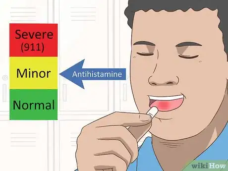 Imagen titulada Reduce Tongue Swelling Step 3