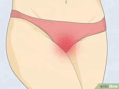 Imagen titulada Keep Your Vagina Cleaner Step 11