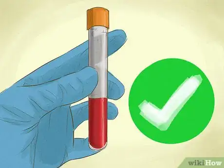 Imagen titulada Increase GFR Step 15