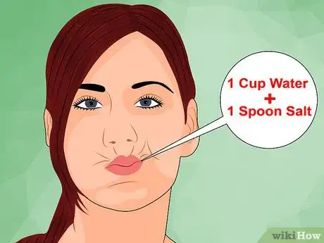 Imagen titulada Ease Wisdom Tooth Pain Step 5