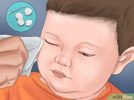 Imagen titulada Administer Eye Drops in Children Step 12